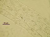 5 – Cellule delle lacinie apicali in visione superficiale